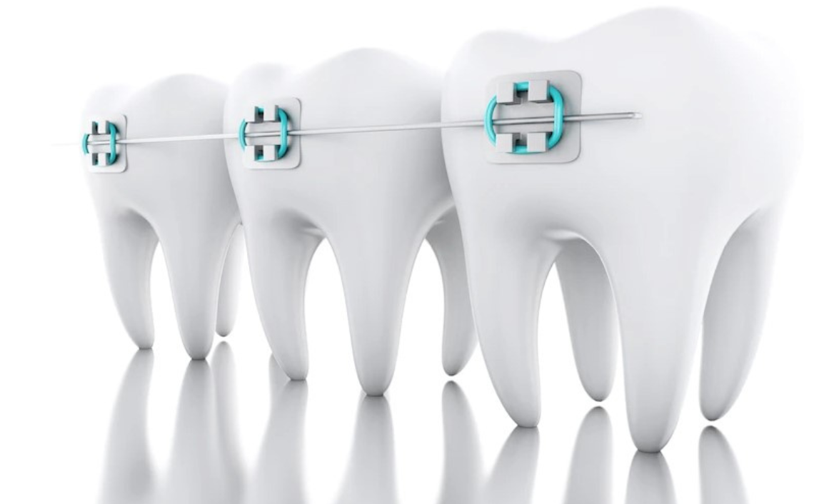 Social media marketing ideas for orthodontists