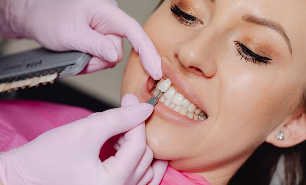 A Dentist Applying a Veneer Tooth on a Patient